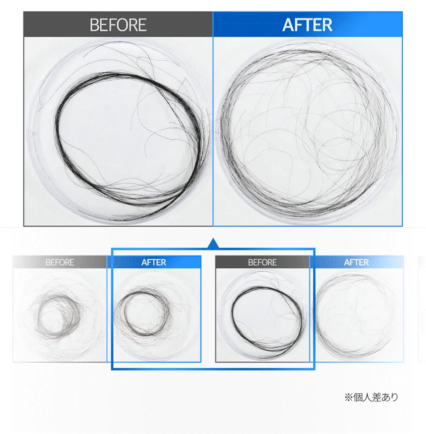 [フォービュート] MTS頭皮ブーストアンプル 1000ブラック | 詳細画像8