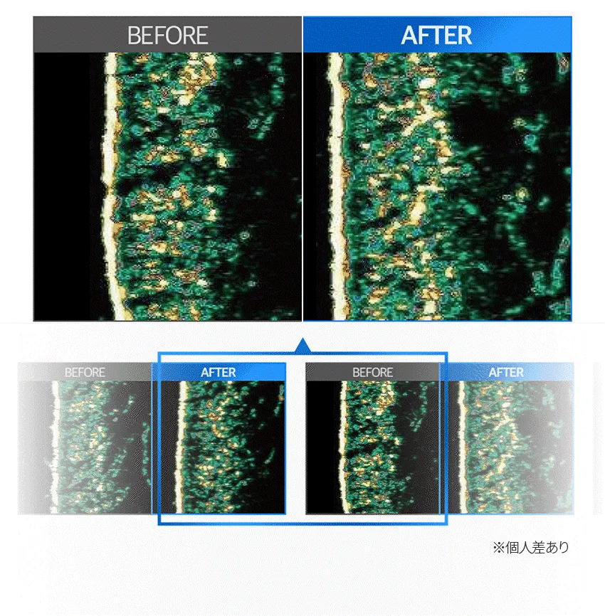[フォービュート] MTS頭皮ブーストアンプル 1000ブラック | 詳細画像10