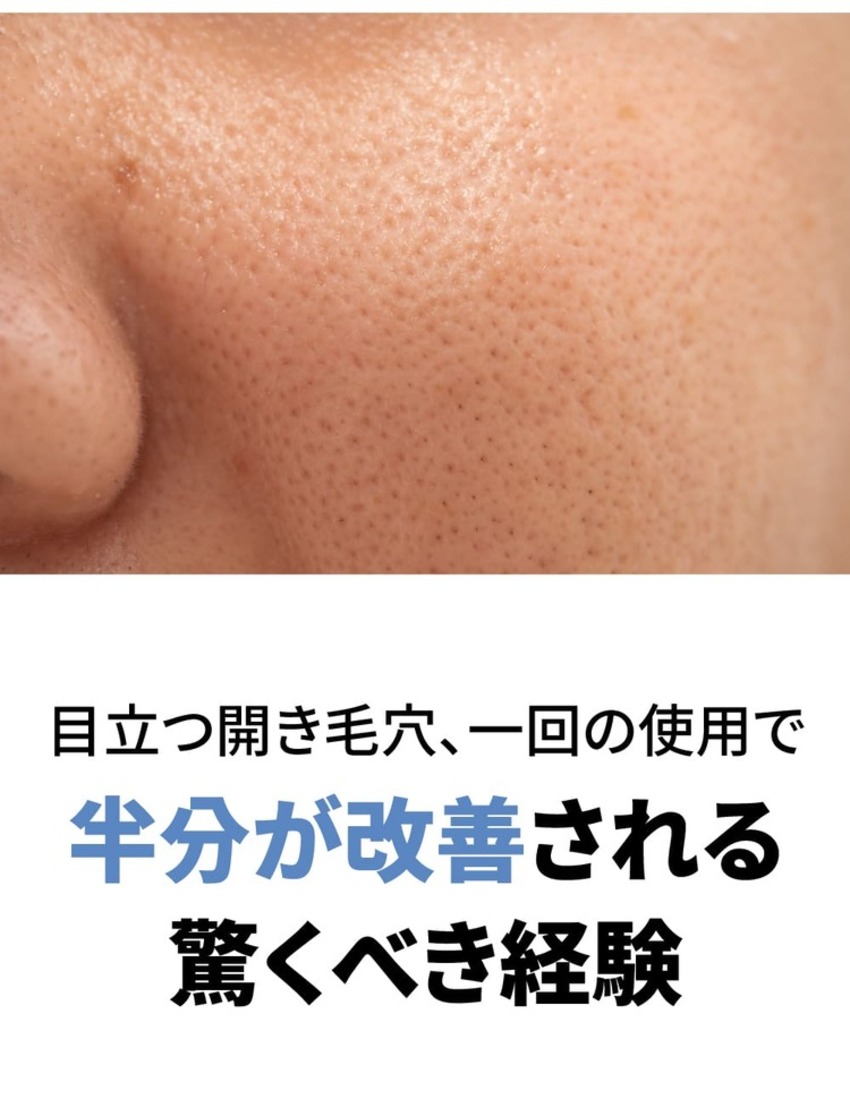 サニコーン] マイクロバイオーム モデリングパック 鎮静毛穴 1セット