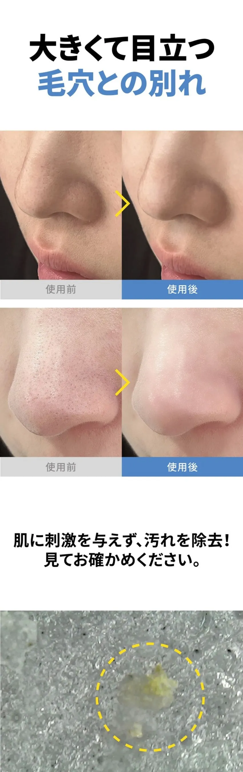 [サニコーン] マイクロバイオーム モデリングパック 鎮静毛穴 1セット（7枚入り | 詳細画像10