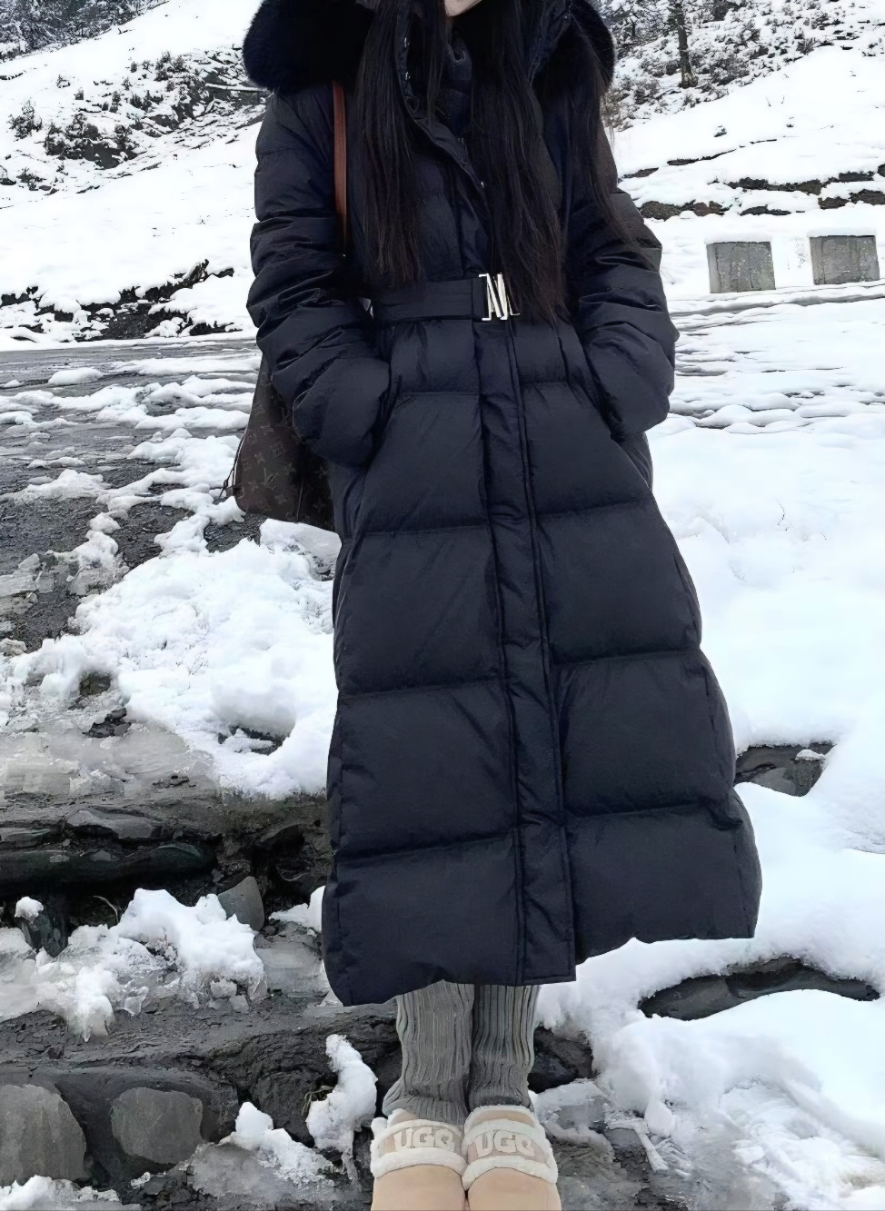 フォックスファージップアップロングAラインダウンジャケット | 詳細画像2