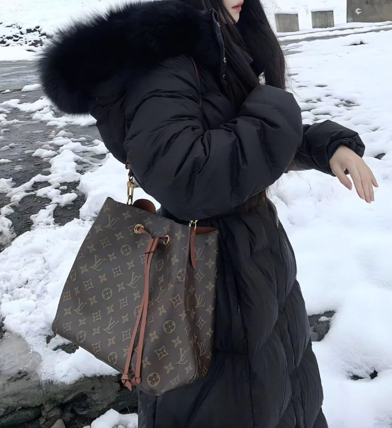 フォックスファージップアップロングAラインダウンジャケット | 詳細画像5