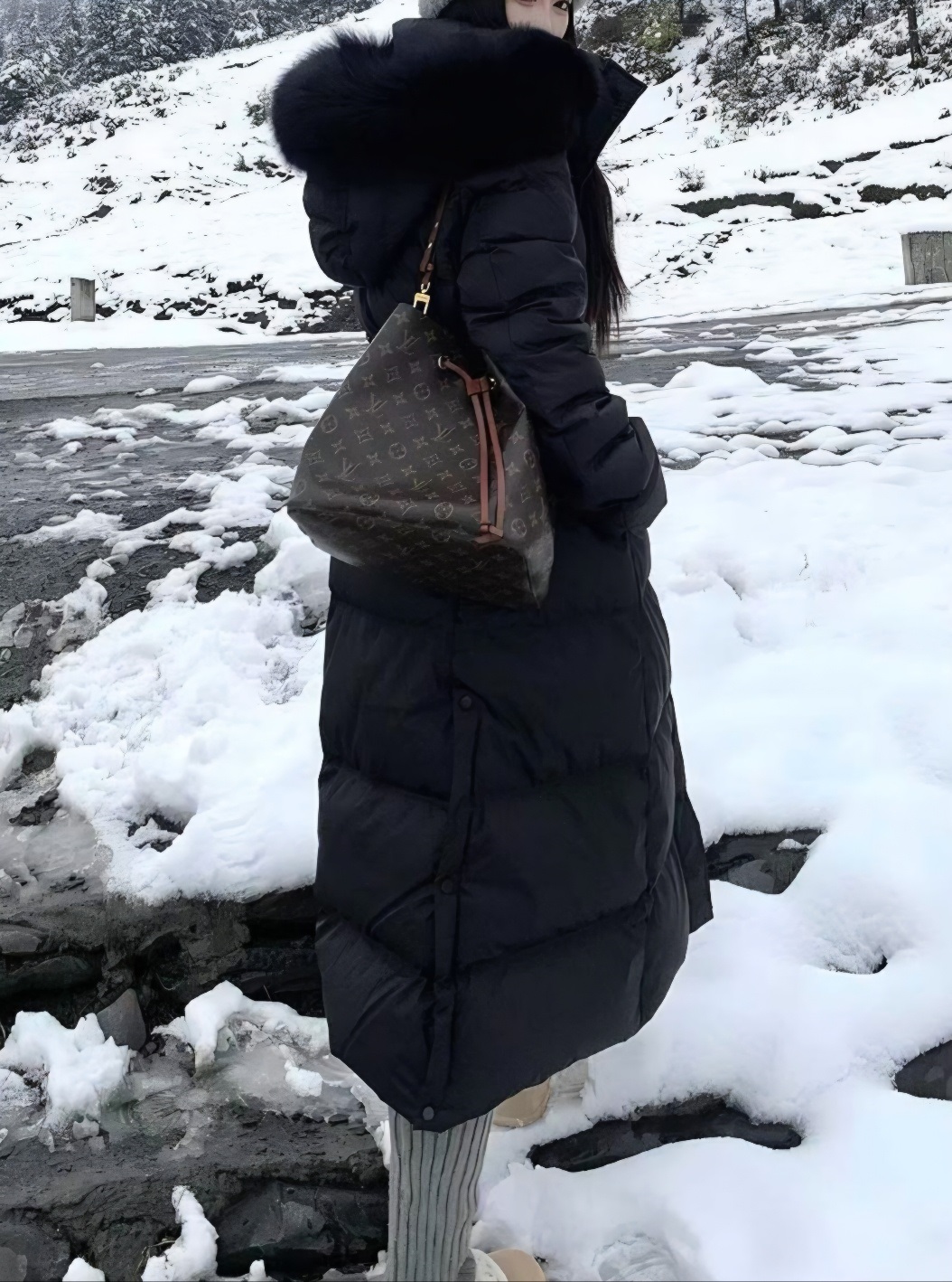 フォックスファージップアップロングAラインダウンジャケット | 詳細画像6