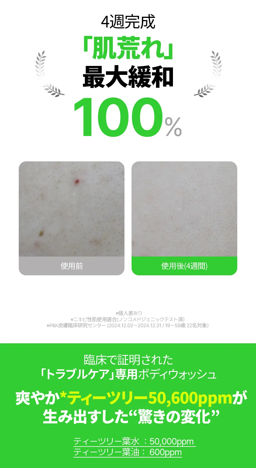 [原料工房] ティーツリー グリーン アクネ ボディーウォッシュ 500ml | 詳細画像3