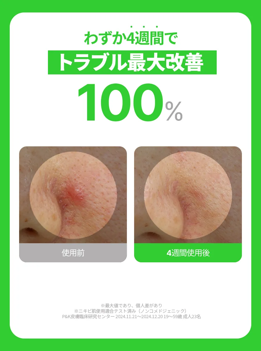 [原料工房] ティーツリーオイルカーミングミスト 100ml | 詳細画像3